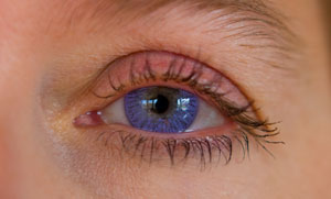 Purple Contact Lens on the Eye